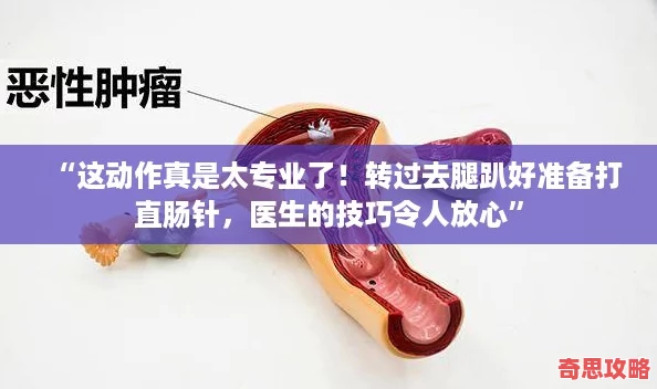 “這動作真是太專業了！轉過去腿趴好準備打直腸針醫生的技巧令人放心”